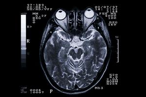 血管年齢を若く保ちたいなら医師に相談