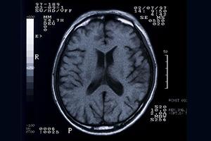 千葉でリウマチの診療を受けたいときには